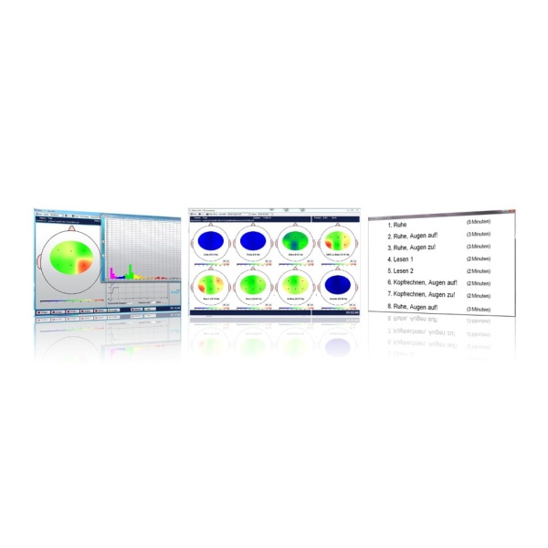 Neurofeedback